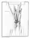 Fig. 22 - Drag-it-easy