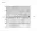 Fig. 05 - Medium discrimination apparatus and discrimination method thereof