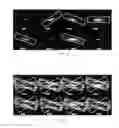 Fig. 05 - Targeted acquisition using holistic ordering (TACHO) approach for high signal to noise imaging