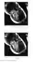 Fig. 07 - Targeted acquisition using holistic ordering (TACHO) approach for high signal to noise imaging