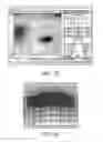 Fig. 08 - Active reduction of electric field generated by a transmit antenna via an auxillary antenna structure