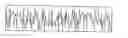 Fig. 01 - Arrangement and method relating to handling of IP traffic