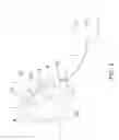 Fig. 02 - Hearing aid