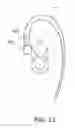 Fig. 12 - Hearing aid