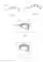 Fig. 07 - METHOD AND APPARATUS FOR IN-THE-EAR HEARING AID WITH CAPACITIVE SENSOR
