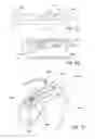 Fig. 07 - Hearing instrument