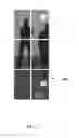 Fig. 14 - Image alignment using translation invariant feature matching