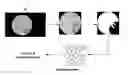 Fig. 01 -  AUTOMATIC OPACITY DETECTION SYSTEM FOR CORTICAL CATARACT DIAGNOSIS
