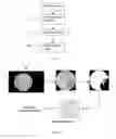 Fig. 02 -  AUTOMATIC OPACITY DETECTION SYSTEM FOR CORTICAL CATARACT DIAGNOSIS