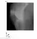 Fig. 17 - X-ray image processing method and X-ray image processing system using open curve fourier descriptors