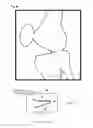 Fig. 18 - X-ray image processing method and X-ray image processing system using open curve fourier descriptors