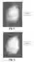 Fig. 03 - Process and system for analyzing the expression of biomarkers in cells