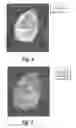 Fig. 04 - Process and system for analyzing the expression of biomarkers in cells