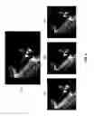 Fig. 07 - Combining seam carving an image resizing