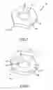 Fig. 08 - Reactive Fasteners