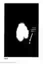Fig. 07 - Cationic steroid antimicrobial diagnostic, detection, screening and imaging methods