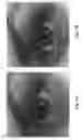 Fig. 02 - Composition and methods for promoting lush hair growth