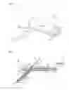 Fig. 05 - SENSOR WITH LAYERED ELECTRODES