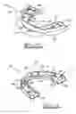 Fig. 07 - Orthodontic appliance