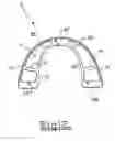 Fig. 08 - Orthodontic appliance