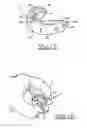 Fig. 09 - Orthodontic appliance