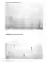 Fig. 02 - Method to identify and predict disease progression of human papilloma virus-infected lesions