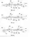Fig. 06 - Immuno gold lateral flow assay