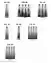 Fig. 09 - Method for fabricating foam scaffolds to culture cells