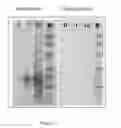 Fig. 08 - DIVA (differentiate infected from vaccinated animals)