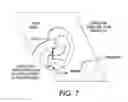 Fig. 06 - Out of plane integral conductive arms and methods for manufacturing the same