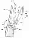 Fig. 01 - Putter training system