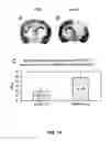 Fig. 16 - METHOD OF TREATING NEURODEGENERATIVE DISEASE