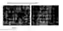 Fig. 04 - Driectly Compressible High Functionality Granular Microcrystalline Cellulose Based Excipient, Manufacturing Process and Use Thereof