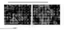 Fig. 06 - Driectly Compressible High Functionality Granular Microcrystalline Cellulose Based Excipient, Manufacturing Process and Use Thereof