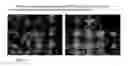 Fig. 07 - Driectly Compressible High Functionality Granular Microcrystalline Cellulose Based Excipient, Manufacturing Process and Use Thereof