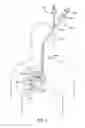 Fig. 02 - DELIVERY METHODS AND DEVICES FOR IMPLANTABLE BRONCHIAL ISOLATION DEVICES