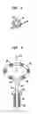Fig. 04 - Miniature circular mapping catheter