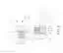 Fig. 03 - NON-INVASIVE DENTAL BASED FIDUCIAL ARRAY