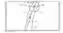 Fig. 01 - Syringe needle guiding apparatus