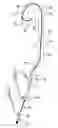 Fig. 01 - COMBINED CATHETER FOR ANGIOGRAPHY