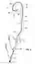 Fig. 04 - COMBINED CATHETER FOR ANGIOGRAPHY