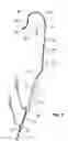 Fig. 06 - COMBINED CATHETER FOR ANGIOGRAPHY