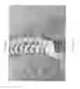 Fig. 03 - SYSTEM FOR DETERMINING AND PLACING SPINAL IMPLANTS OR PROSTHESES