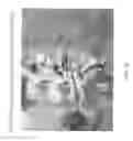 Fig. 32 - SYSTEM FOR DETERMINING AND PLACING SPINAL IMPLANTS OR PROSTHESES