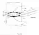 Fig. 37 - SYSTEM FOR DETERMINING AND PLACING SPINAL IMPLANTS OR PROSTHESES
