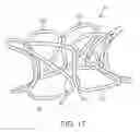 Fig. 06 - Method for establishing an artificial arterio-venous fistula