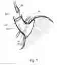 Fig. 08 - Bariatric device and method