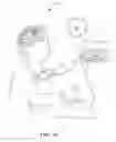 Fig. 02 - System for patent interactive neural stimulation with robotic facilitation of limb movement
