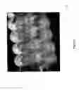 Fig. 04 - THERAPEUTIC DEVICE