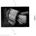 Fig. 07 - THERAPEUTIC DEVICE